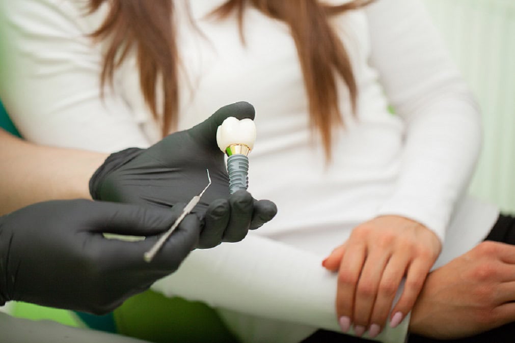 Implant zęba trzonowego – kiedy warto rozważyć jego wszczepienie?